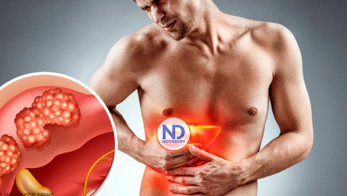 Casos y muertes por cáncer de hígado aumentarán 55% a 2040