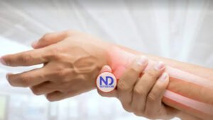 Día Mundial de la Osteoporosis, una enfermedad silenciosa