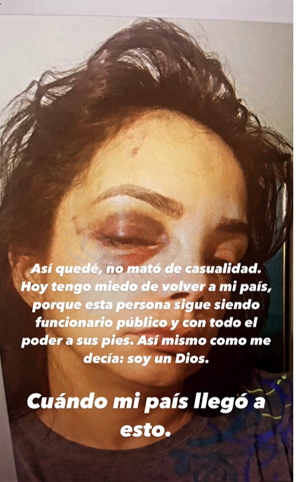 AURORA DIAZ 1 "No me mató de casualidad", ex esposa del superintendente de Pensiones lo acusa de haberle dado una golpiza