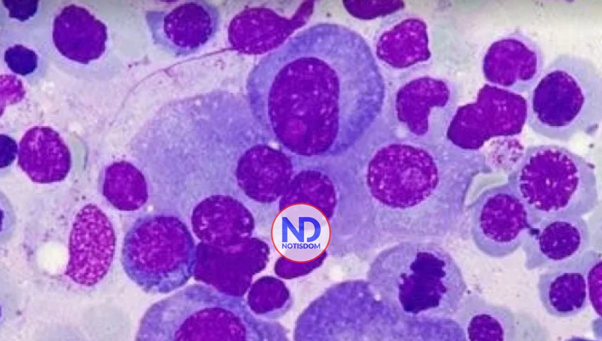 Descubren las bases moleculares de la resistencia a un fármaco contra mieloma