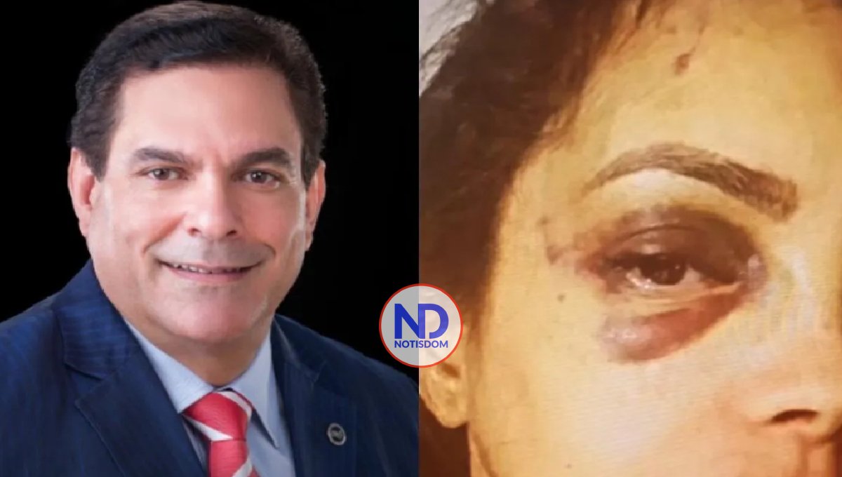 «No me mató de casualidad», ex esposa del superintendente de Pensiones lo acusa de haberle dado una golpiza