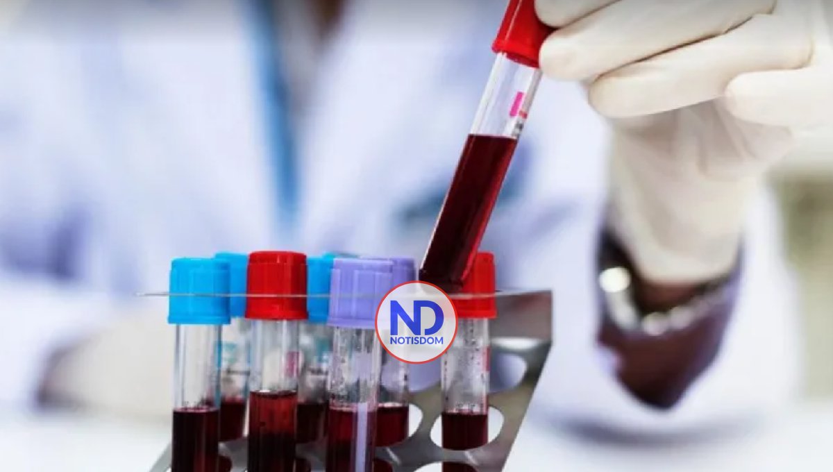 Un análisis de sangre para identificar un biomarcador del alzhéimer