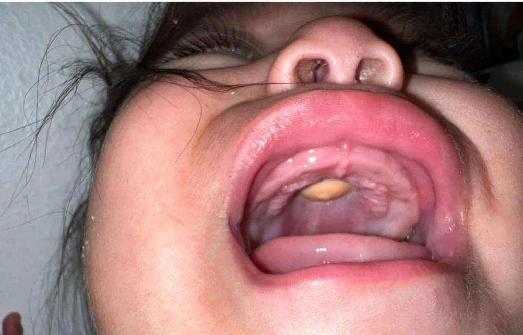 Odontopediatra advierte sobre riesgo de juguetes popis en bebés 3 BEBE 16 Odontopediatra advierte sobre riesgo de juguetes popis en bebés