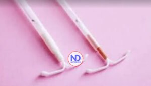 Ventajas y desventajas de utilizar el DIU como método anticonceptivo