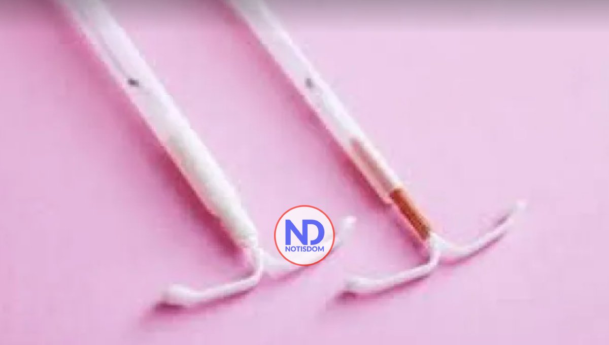 Ventajas y desventajas de utilizar el DIU como método anticonceptivo 2 Ventajas y desventajas de utilizar el DIU como método anticonceptivo