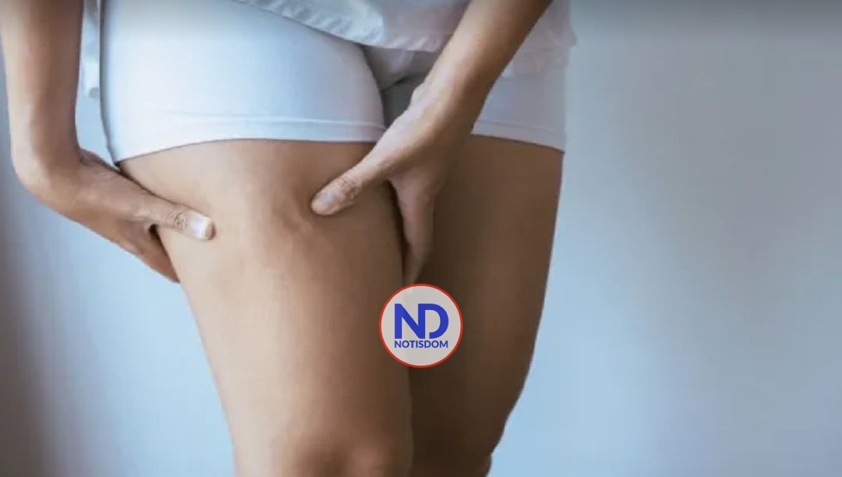 ¿Qué es y cómo tratar la retención de líquidos? 2 ¿Qué es y cómo tratar la retención de líquidos?