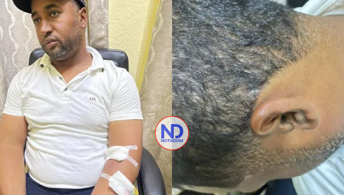 Se entrega sargento PN acusado de ultimar dos personas y herir otras dos en Baní