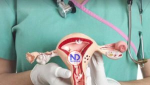 Sanar el síndrome de ovarios poliquísticos para ser madre