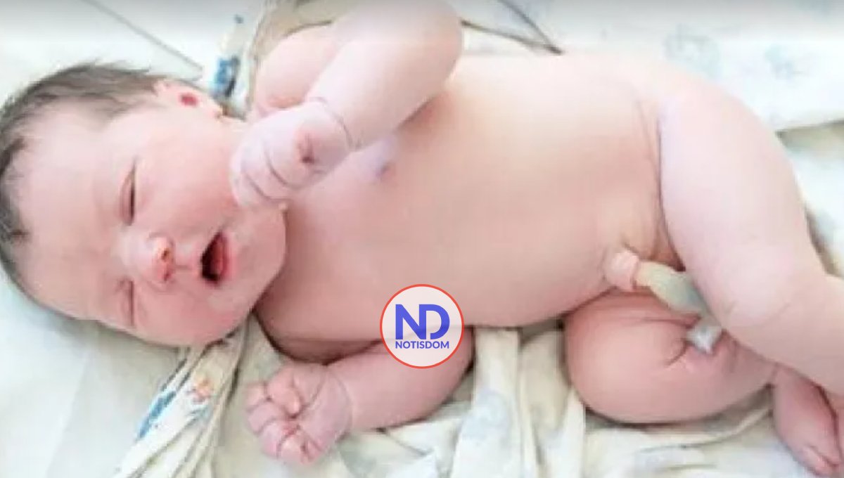 ¿Cuándo se debe operar una hernia umbilical en un bebé?