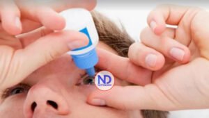 Causas que provocan la conjuntivitis