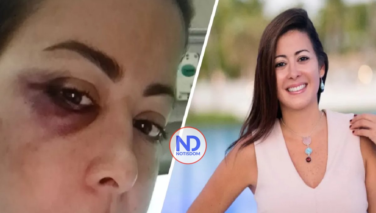 Operan dos veces a Dafne Guzmán tras caerse de su cama mientras dormía