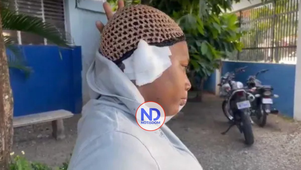 ¡Bocado salvaje! Mujer le arranca oreja a otra en medio de pelea