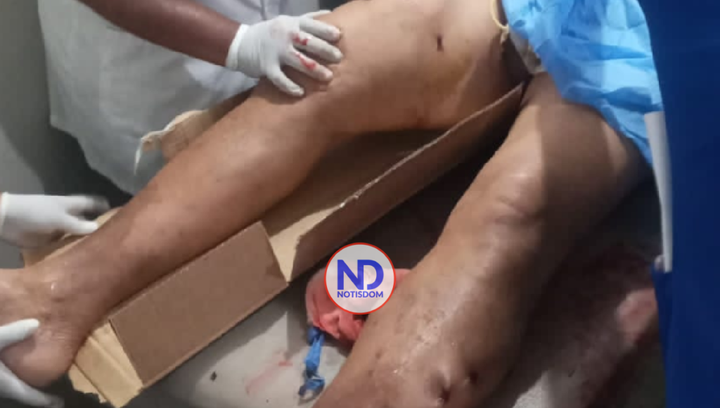 NOTISDOM FOTOS 2023 01 12T125243.989 Policía retirado hiere general FARD de varios disparos y machetazos en su finca [fotos]