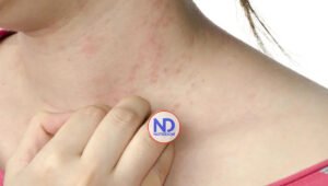 Recomiendan uso de probióticos en diarreas y dermatitis atópicas