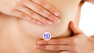 La discriminación es un factor de una mortalidad más alta por cáncer de mama