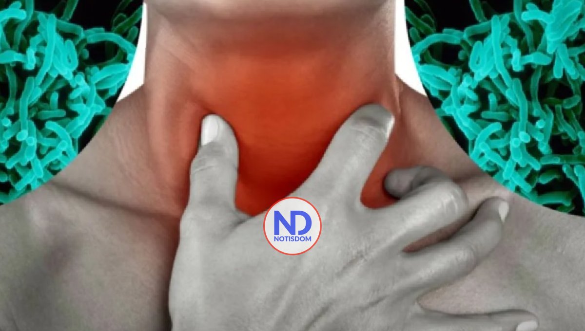 Salud Pública confirma cuatro casos de difteria, entre ellos un deceso