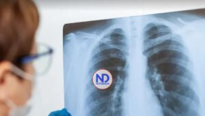 Consejos para la prevención de la neumonía