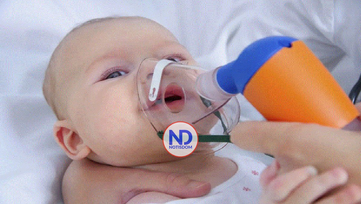 La bronquiolitis es la infección más frecuente entre niños de seis meses a un año