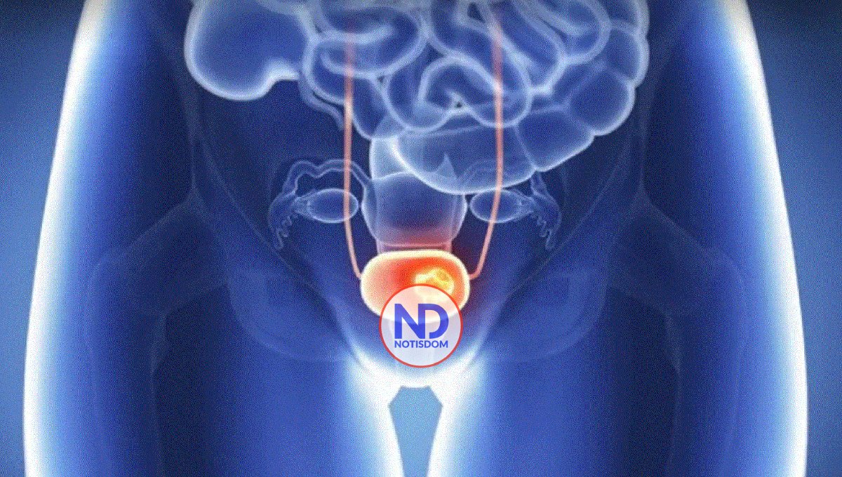 Descuido podría aumentar riesgos de cáncer de cérvix