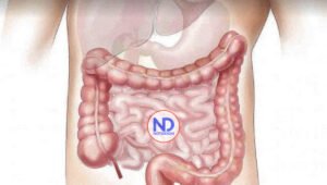 Cáncer de colon el cuarto más diagnosticado en RD