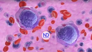 Un fármaco experimental logra remitir la leucemia aguda en 18 pacientes