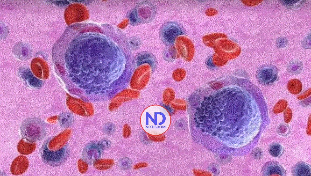 Un fármaco experimental logra remitir la leucemia aguda en 18 pacientes