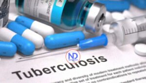 Vacuna española de la tuberculosis inicia la fase 3 para verificar seguridad