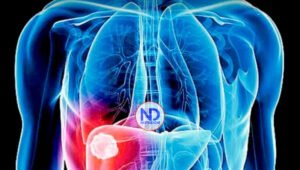 Inflamación de la vesícula: por qué se produce y cómo es el tratamiento