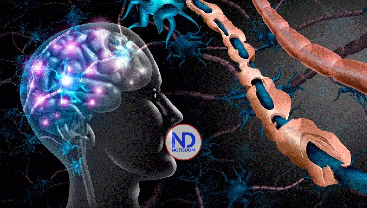 Un fármaco puede retrasar los primeros síntomas de la esclerosis múltiple