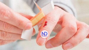 Solo 10 % hemofilicos tiene acceso a tratamiento