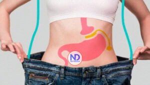 La cirugía bariátrica, más que perder peso es ganar salud