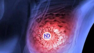 Identifican la capacidad antitumoral de un pigmento frente al cáncer de mama