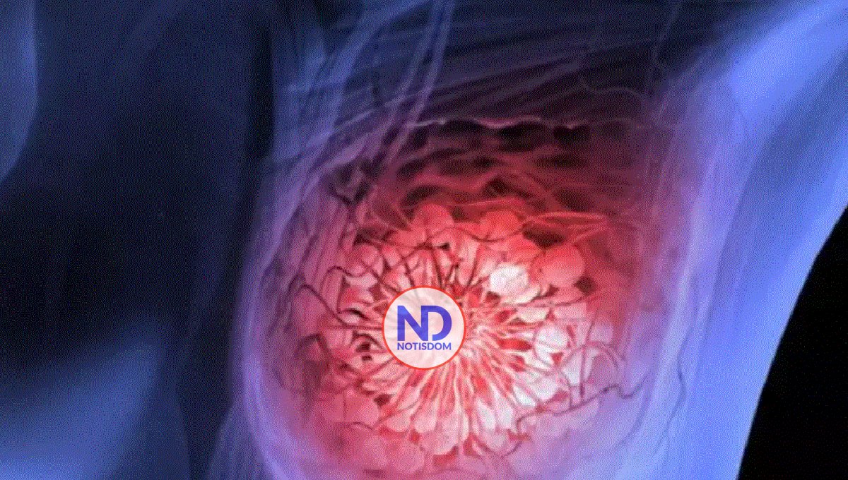 Identifican la capacidad antitumoral de un pigmento frente al cáncer de mama
