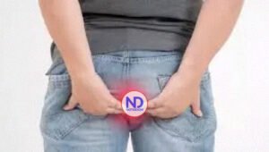 Diez consejos para prevenir y tratar las hemorroides