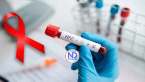 VIH entre las personas en prisión aumentó un 13% a nivel mundial