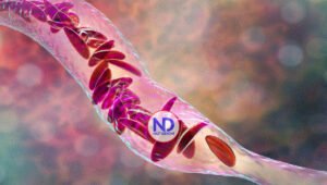 La nueva terapia génica para pacientes con anemia de células falciformes