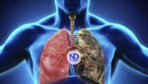 Un nuevo tratamiento aumenta la supervivencia en pacientes con cáncer de pulmón