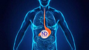 ¿Cuáles son los tres alimentos que más reflujo gástrico generan?