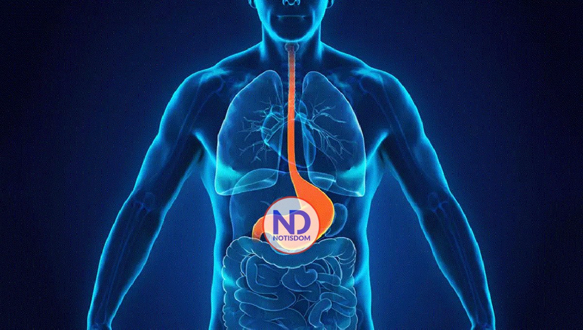 ¿Cuáles son los tres alimentos que más reflujo gástrico generan?