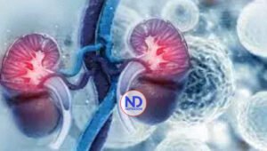 Día Mundial del Cáncer de Riñón: mantener la calidad de vida