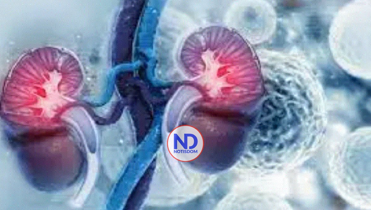 Día Mundial del Cáncer de Riñón: mantener la calidad de vida