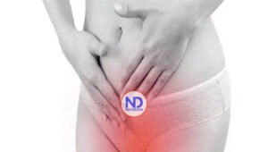 La candidiasis tambien se produce por estrés y estar mucho tiempo sentada