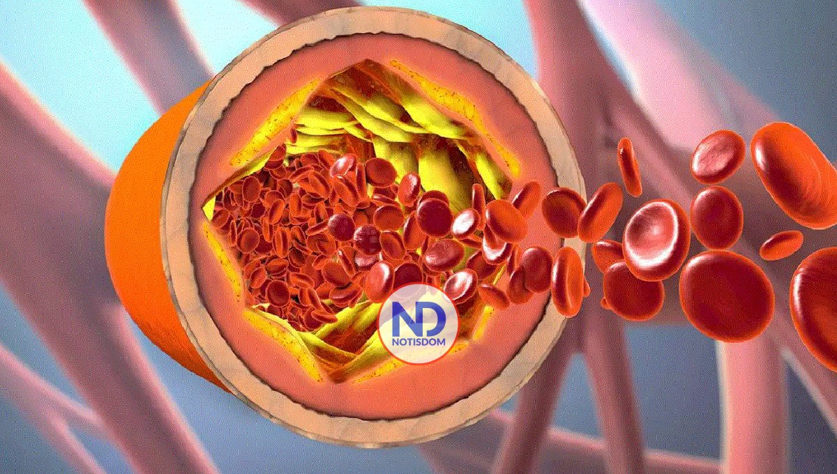 ¿Cuáles son las frutas que pueden ayudar a reducir el colesterol?