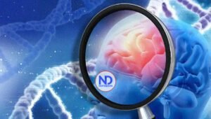 Por qué sucede la demencia