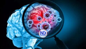 Siete muertos en EEUU por brote de meningitis fúngica relacionada con clínicas en México