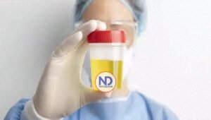 Una muestra de orina puede diagnosticar el cáncer de endometrio