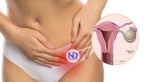 Tengo un quiste en mi ovario derecho ¿Puedo lograr embarazarme?