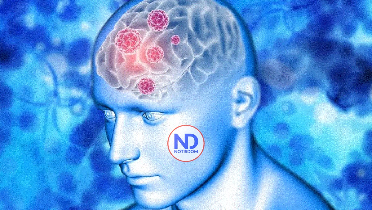 Alzhéimer precoz, una enfermedad poco frecuente