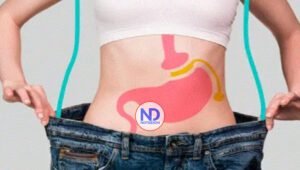 Cirugía bariátrica una alternativa para mejorar la diabetes tipo 2