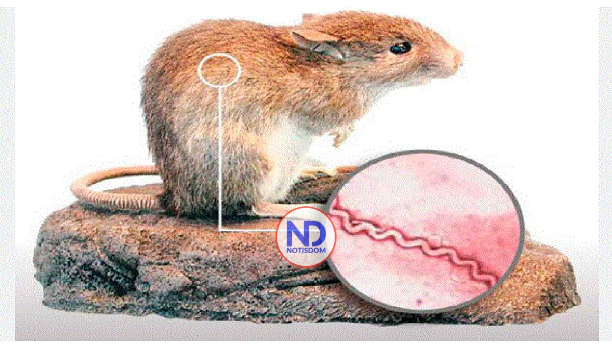 Casos de leptospirosis podrían aumentar por lluvias 2 Casos de leptospirosis podrían aumentar por lluvias